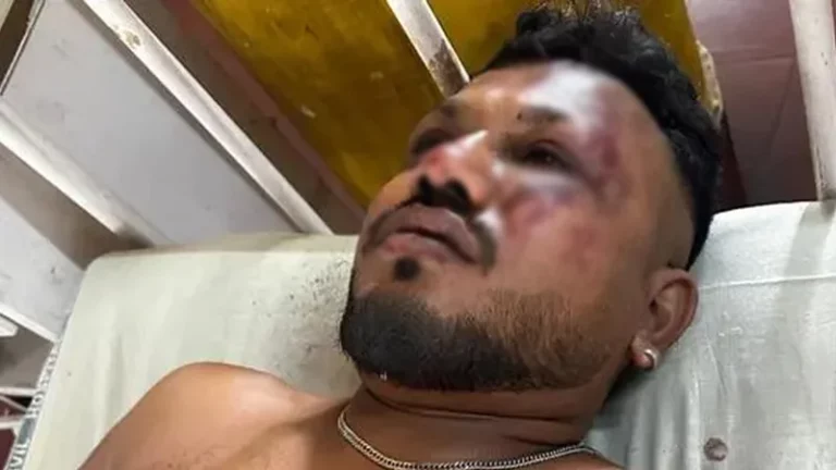 বিধ্বস্ত উড়োজাহাজের এক যাত্রীকে জীবিত উদ্ধার: পুলিশ